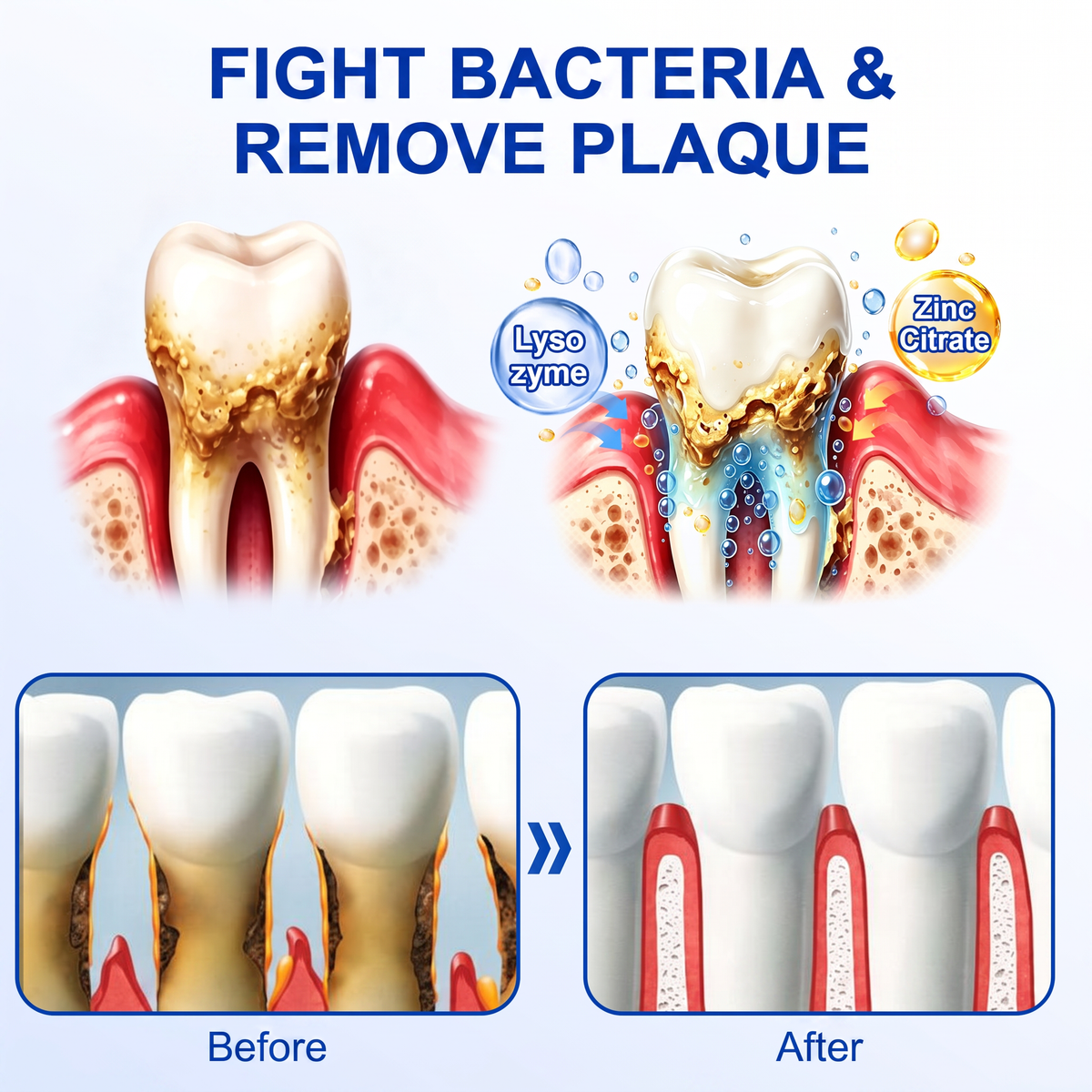 🇿🇦Pureluxo® 🦷  periodontal repair gel 🧑‍⚕️
